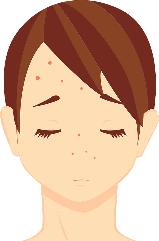 Acne PNG Picture
