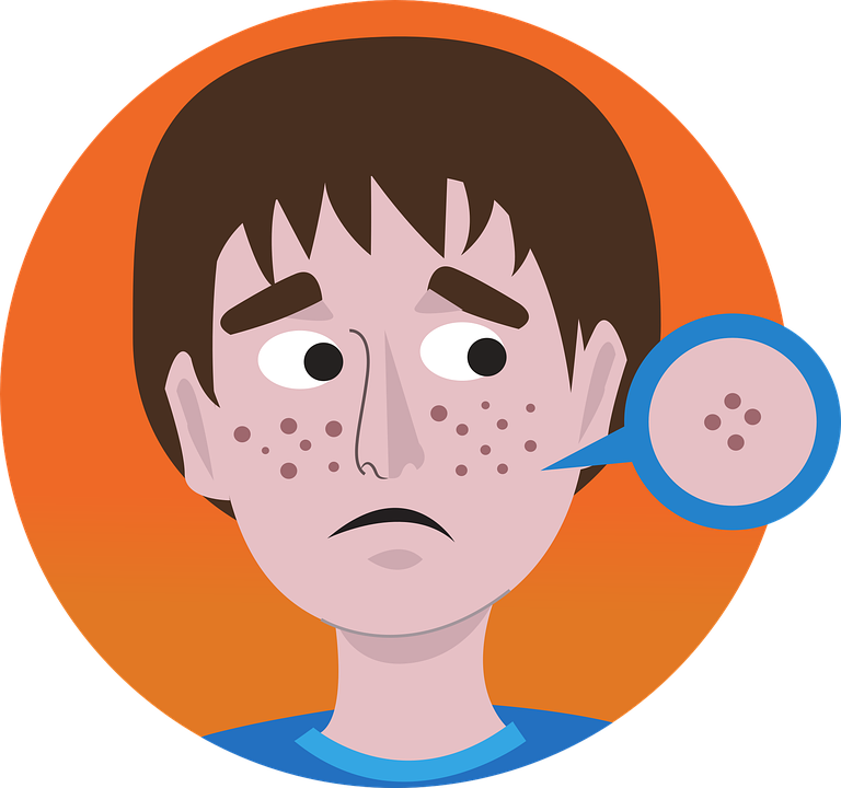 Acne Vector PNG Image