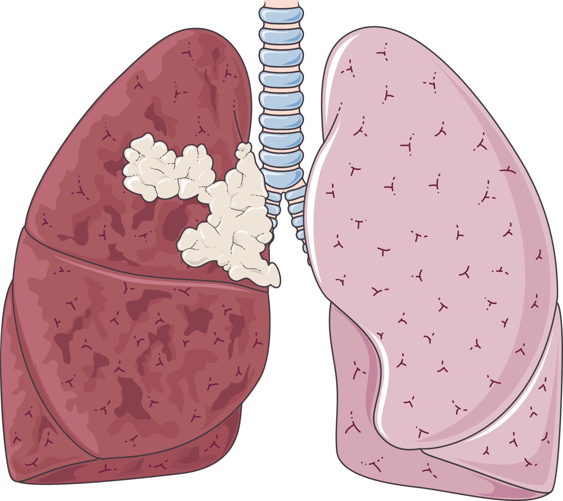 Lung PNG Isolated Pic