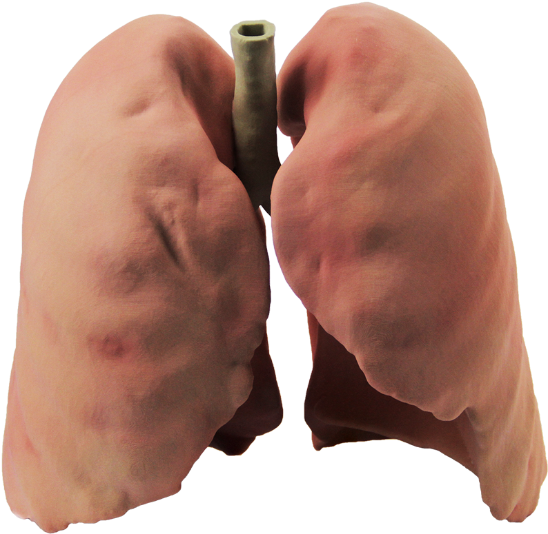 Lung PNG Photo