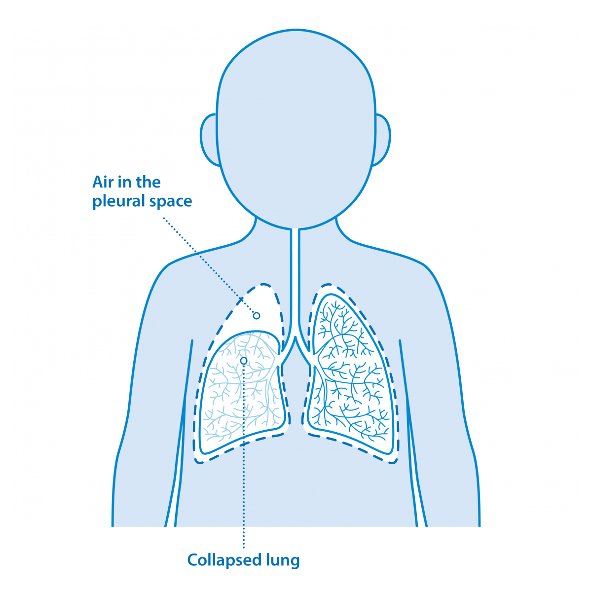 Lungs PNG Pic