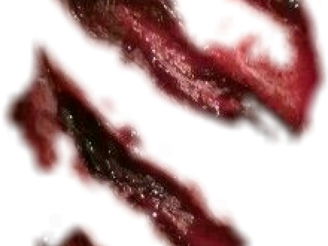 Wound PNG Transparent