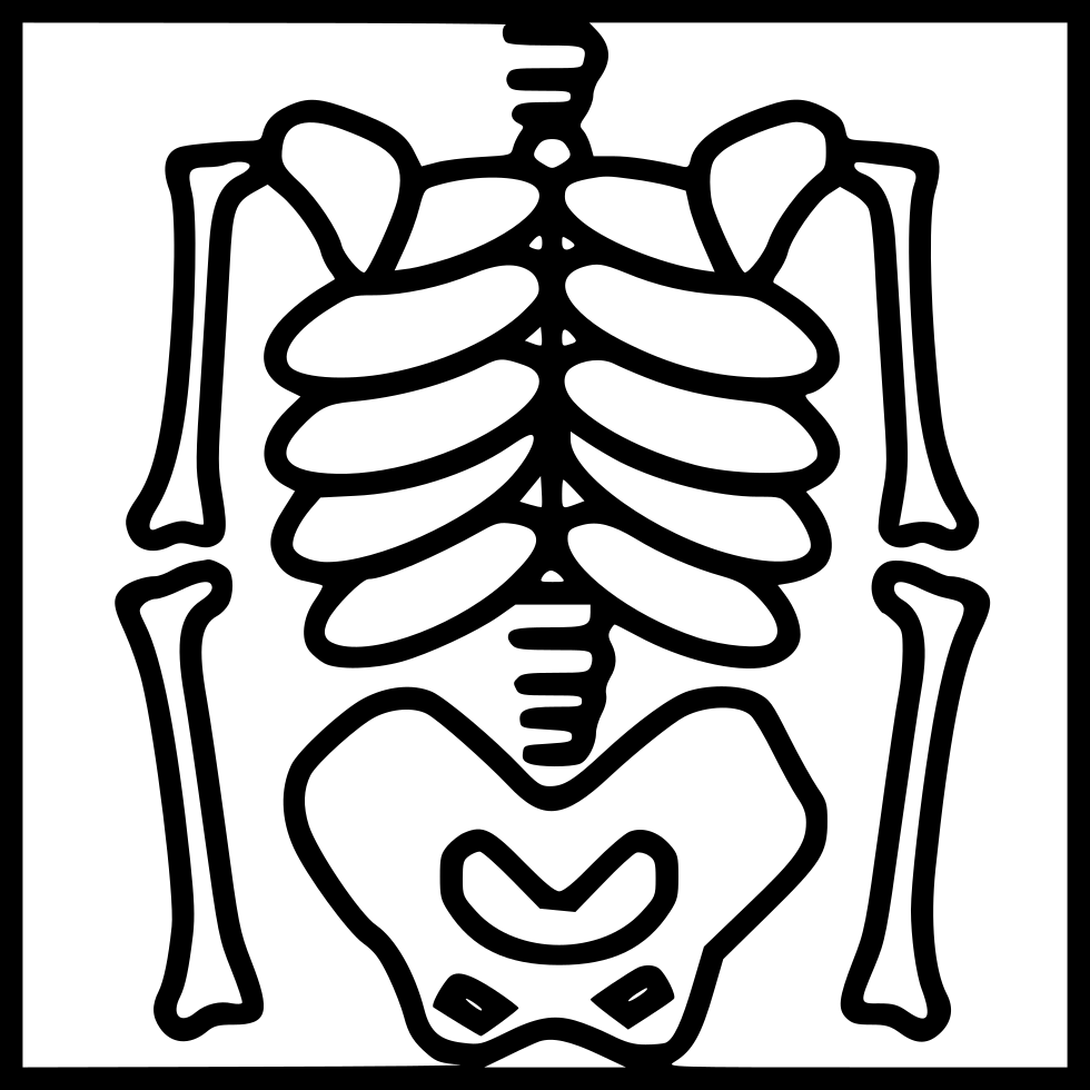 X-Ray PNG Isolated File