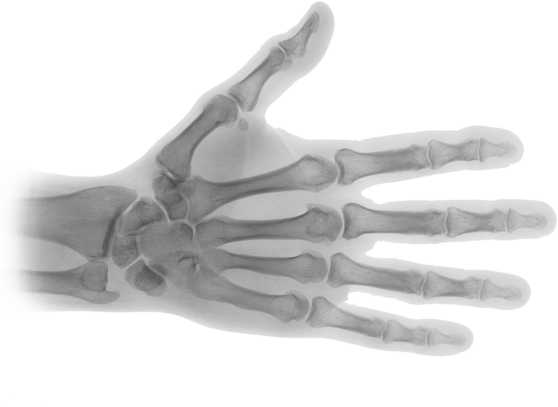 X-Ray PNG Transparent Picture
