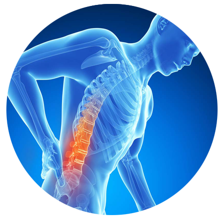 Rückenschmerzen PNG-Bild