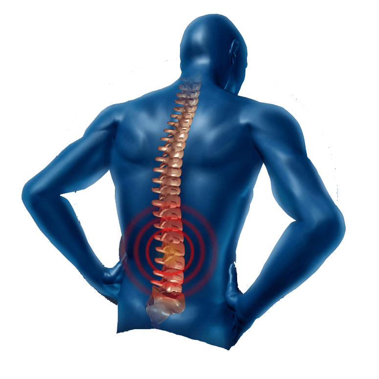 Rückenschmerzen transparent PNG