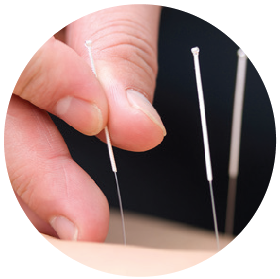 Acupuncture PNG Photos